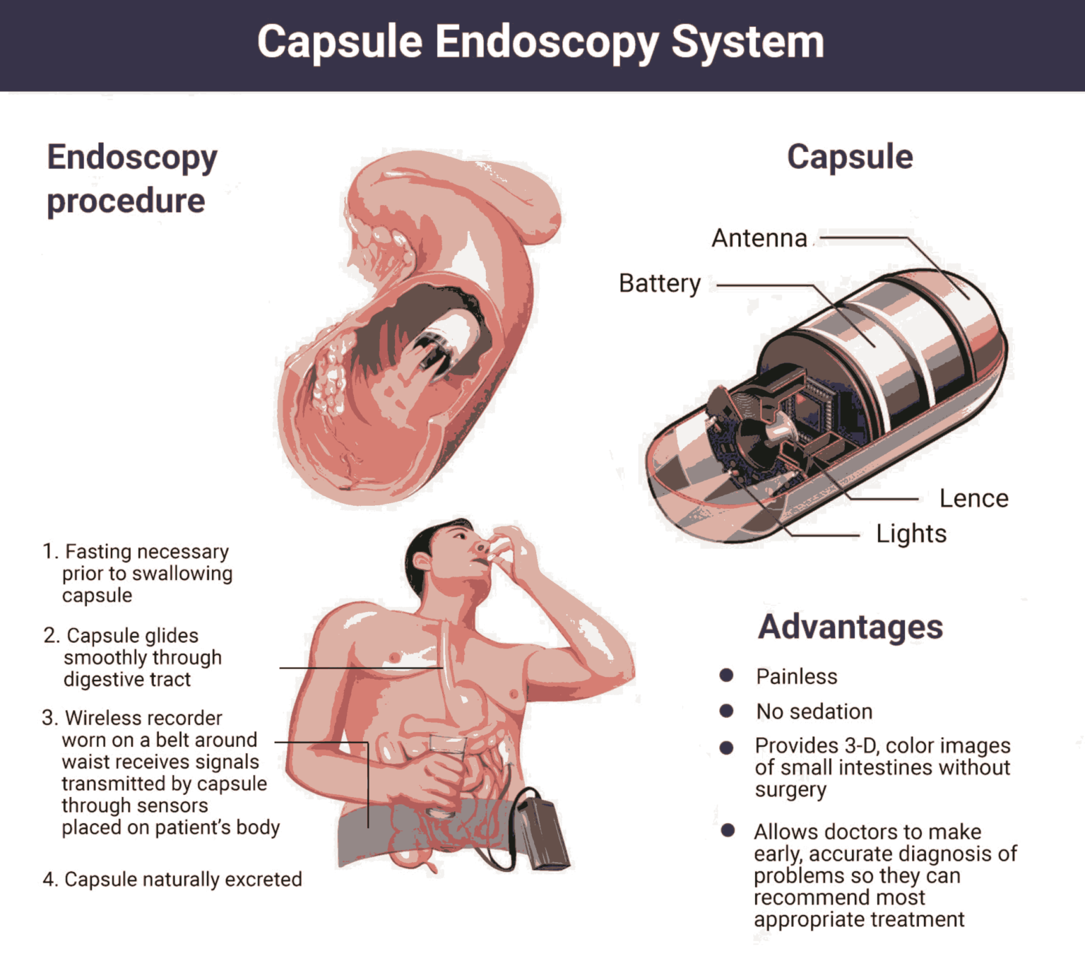Aga Khan Hospital Introduces NonInvasive Capsule Endoscopy