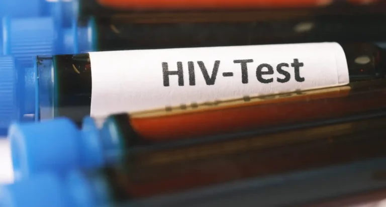 Blood samples for HIV Test. The National Syndemic Diseases Control Council (NSDCC) has released a report on HIV prevalence in Kenya by county.